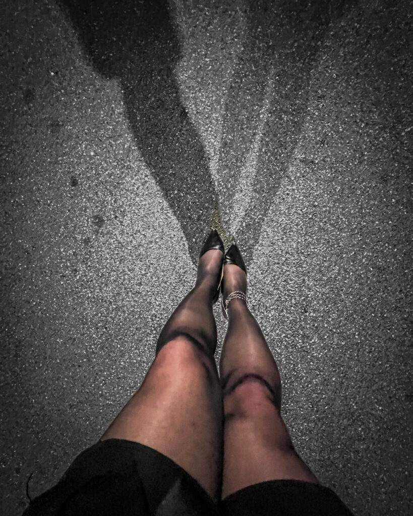A man's legs in shiny black pantyhose and heels